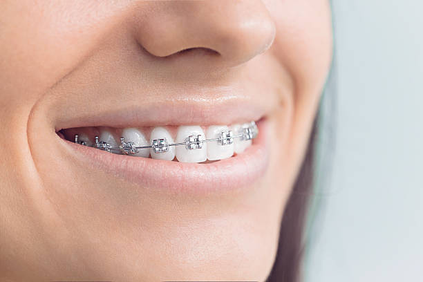 Dental Inlays and Onlays in Flanders, NJ